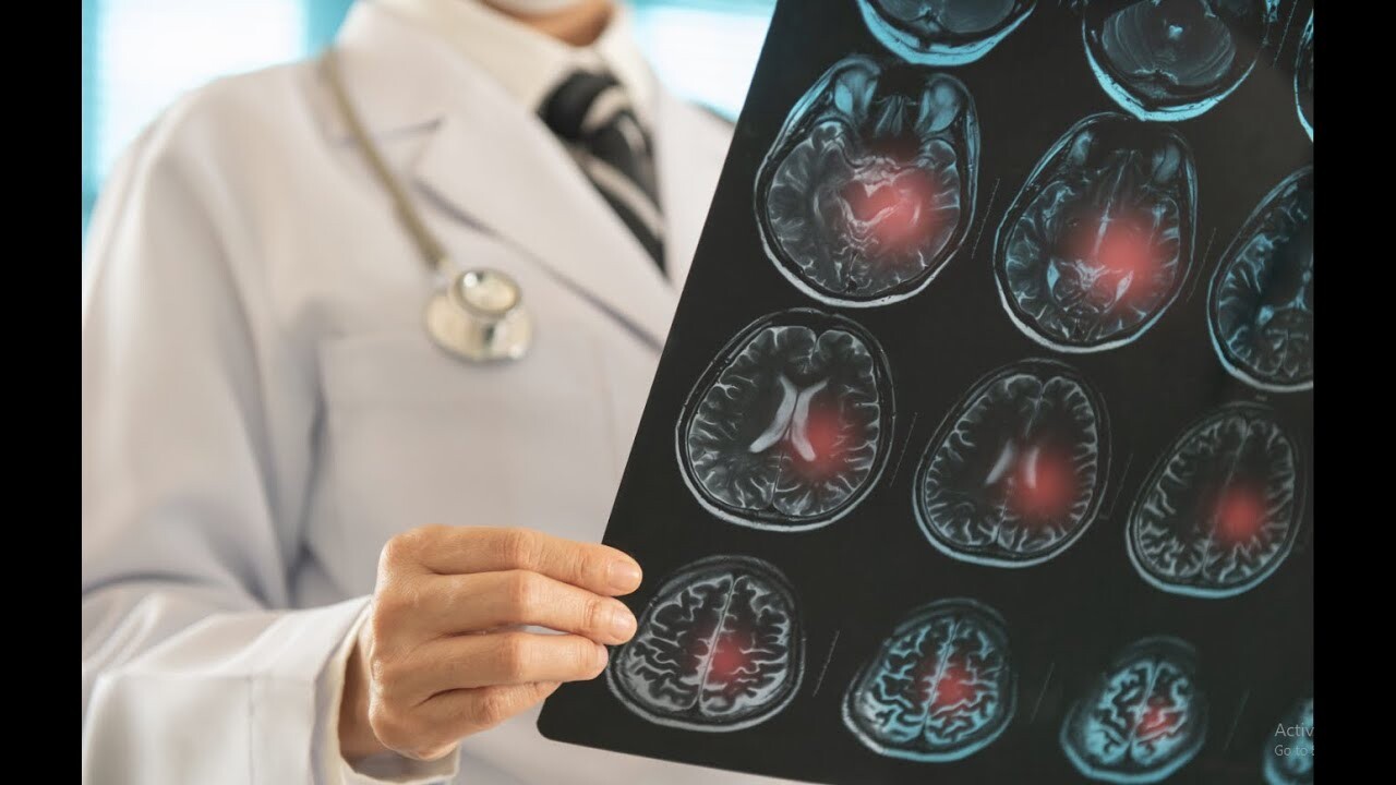 Video Thumbnail: ĐỘt QuỴ: Phòng Bệnh Hơn Chữa Bệnh