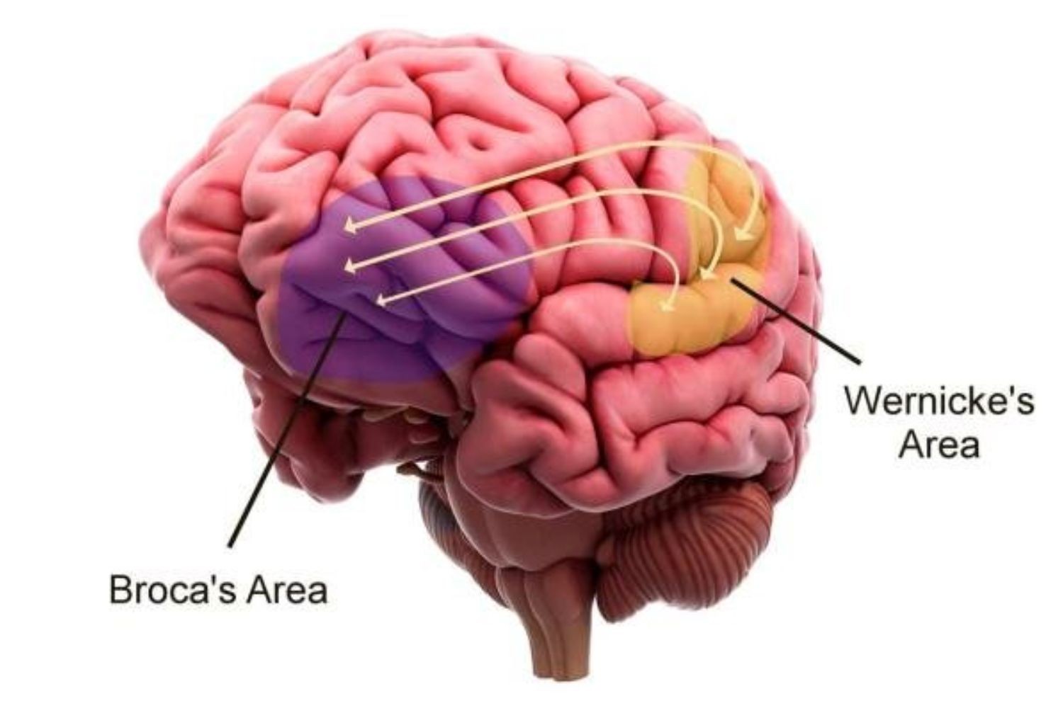 Tổn thương ở 2 vùng não sẽ gây ảnh hưởng đến khả năng sử dụng ngôn ngữ