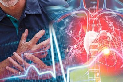 Những yếu tố liên quan đến tim mạch có nguy cơ gây đột quỵ cao