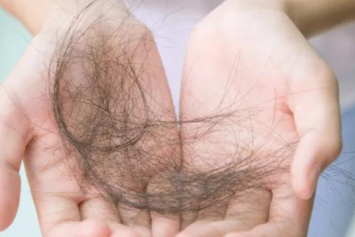 Những nguy cơ có thể xảy ra khi cấy tóc