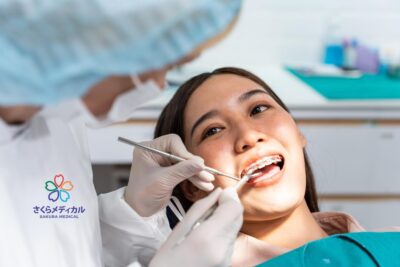 Người lớn có nên niềng răng? Những điều cần cân nhắc