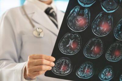 CẢNH BẢO NGUY CƠ ĐỘT QUỴ BẤT NGỜ