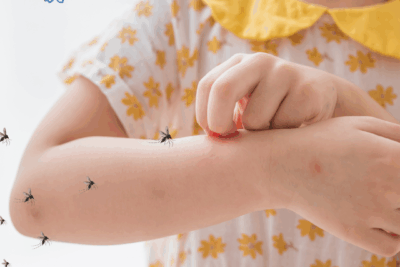 SỐT XUẤT HUYẾT: ĐỪNG CHỦ QUAN TRƯỚC NHỮNG TRIỆU CHỨNG BAN ĐẦU